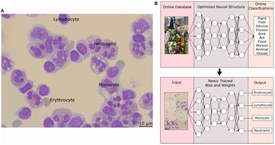 Establishment and Verification of Neural Network for Rapid and Accurate Cytological Examination of Four Types of Cerebrospinal Fluid Cells